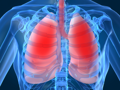 http://blogs.biomedcentral.com/bmcblog/files/2013/06/lung-infection3.jpg