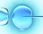 IVF_in vitro fertilisation