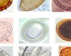 Collage_of_various_helminth_eggs-602x342