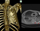 12. Computed Tomography (CT) imaging quality of the skeletal system of an embalmed human cadaver
