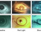 8. Ocular fundus, chromatic pupillary light reflexes, and electroretinogram of a day-blind Miniature Australian Shepherd dog