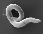 The worm Caenorhabditis elegans is a very well-studied model organism in biology