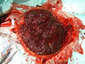 A human placenta - not easy to break up into modules...