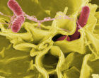 Credit: Rocky Mountain Laboratories,NIAID,NIH
Color-enhanced scanning electron micrograph showing Salmonella typhimurium (red) invading cultured human cells.
