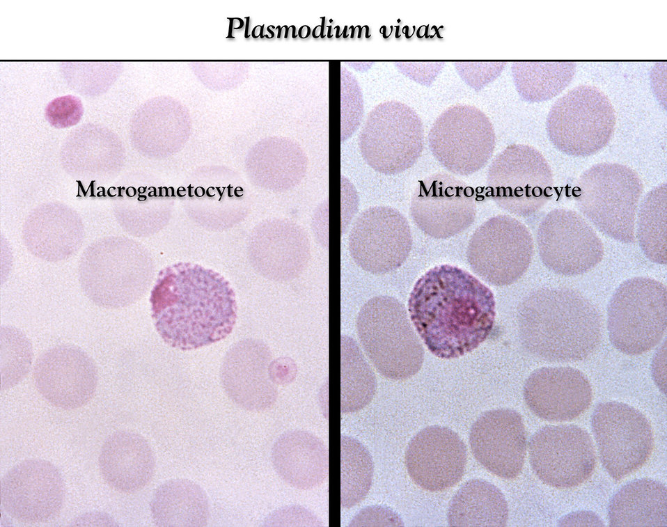malária plazmodium mikrogametocita)