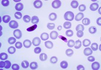 P. falciparum gametocytes