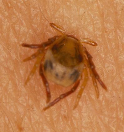 Ixodes holocyclus adult female attached to human skin surface (Wikimedia commons)
