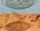 Wet mounts of eggs of S. haematobium (top) and S. intercalatum (bottom) showing characteristic terminal spine, image courtesy of DPDx/CDC