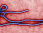 Ebolavirus  - public domain (CDC)