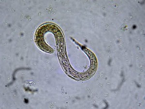 Larval Strogyloides stercoralis from a faecal sample. Image taken by blogger Yuri