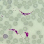 Trypanosoma rangeli blood trypomastigotes are often mistaken for blood form trypomastigotes of Trypanosoma cruzi leading to unnecessary and dangerous treatment