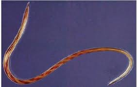 Adult Haemonchus cortortus the Barber’s pole nematode