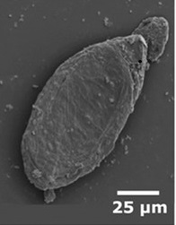 Paleoxyuris cockburni egg from coprolite (SEM microscopy). Image taken from Hugot et al, 2014