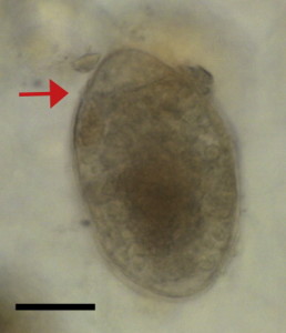 Diphyllobothrium sp. (fish tapeworm) egg from coprolite 11. Dimensions 65 × 40 μm. Arrow indicates the operculum. Black bar indicates 20 μm. (Fig. 8 of Yeh et al., 2015)
