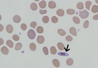 796px-P._falciparum_thin_smear_gametocyte