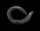 Electron micrograph of an adult male Schistosome. Bar at bottom left represents 500 μm.
Photo Credit – David Williams, Illinois State University retrieved from: https://en.wikipedia.org/wiki/Schistosoma