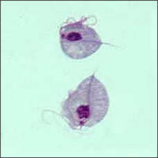 Trichomonas vaginalis: wikicomons obrázek