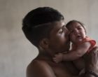 A child born with microcephaly, image from Associated Press