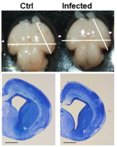 Images showing the smaller size of mouse brains infected with ZIKV relative to the mock infected (control, Ctrl). Lower panel: sections of the same brains. Source: https://www.sciencedirect.com/science/article/pii/S1934590916300844 