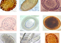 Collage_of_various_helminth_eggs