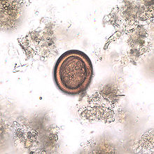 Echinococcus egg in faeces. Source: https://en.wikipedia.org/wiki/Echinococcosis
