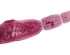 Stained adult Echinococcus multilocularis. Source: Wikicommons –Alan R. Walker