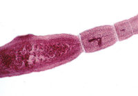 800px-echinococcus-multilocularis-adult