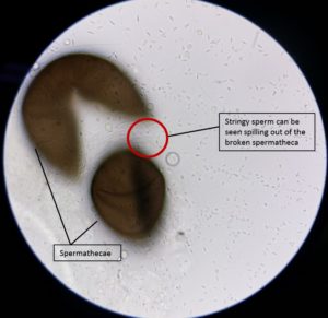  Sperm spilling from a broken spermatheca. Image by: Theodore Lee, https://taxo4254.wikispaces.com/Aedes+albopictus 