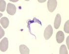 Giemsa-stained Trypanosoma brucei parasite in a blood sample. Red blood cells appear as grey circular shapes. Source: Public Health Image Library, CDC/Blaine Mathison