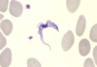 Figure 2 – trypanosome