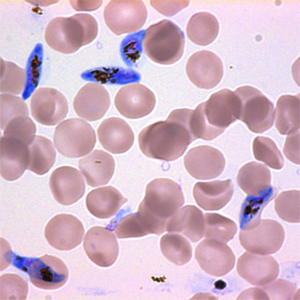 Plasmodium Falciparum Microbiology Laboratory Turkey - Riset