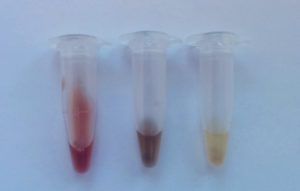 Blood-fed mosquito abdomens crushed into solution showing different degrees of digestion. From left to right: a recently (<24 hours) blood-fed mosquito, 2-4 days after blood-feeding and 4+ days after blood-feeding. Source: V Brugman.