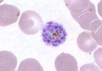 Schizont_of_P._vivax_in_a_thin_blood_smear