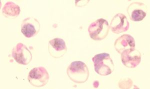 a Plasmodium malária szexuális reprodukciója következik be