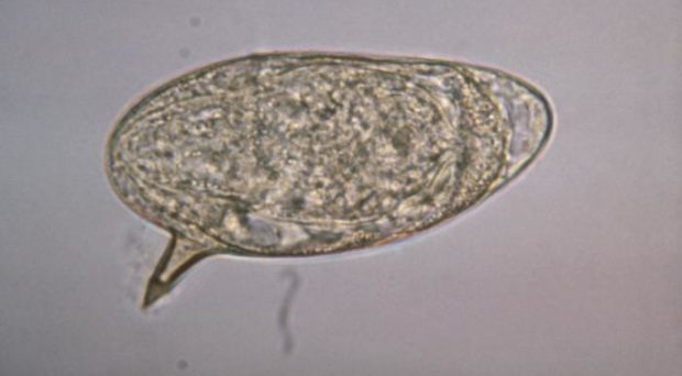 schistosoma mansoni