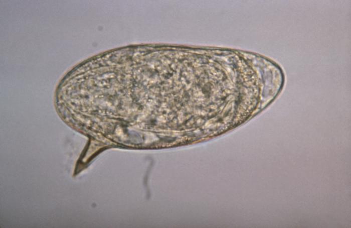 mansoni schistosomiasis a széklet nyálkahártyájának parazitái