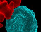 malaria_infected_red_blood_cell_NIAID