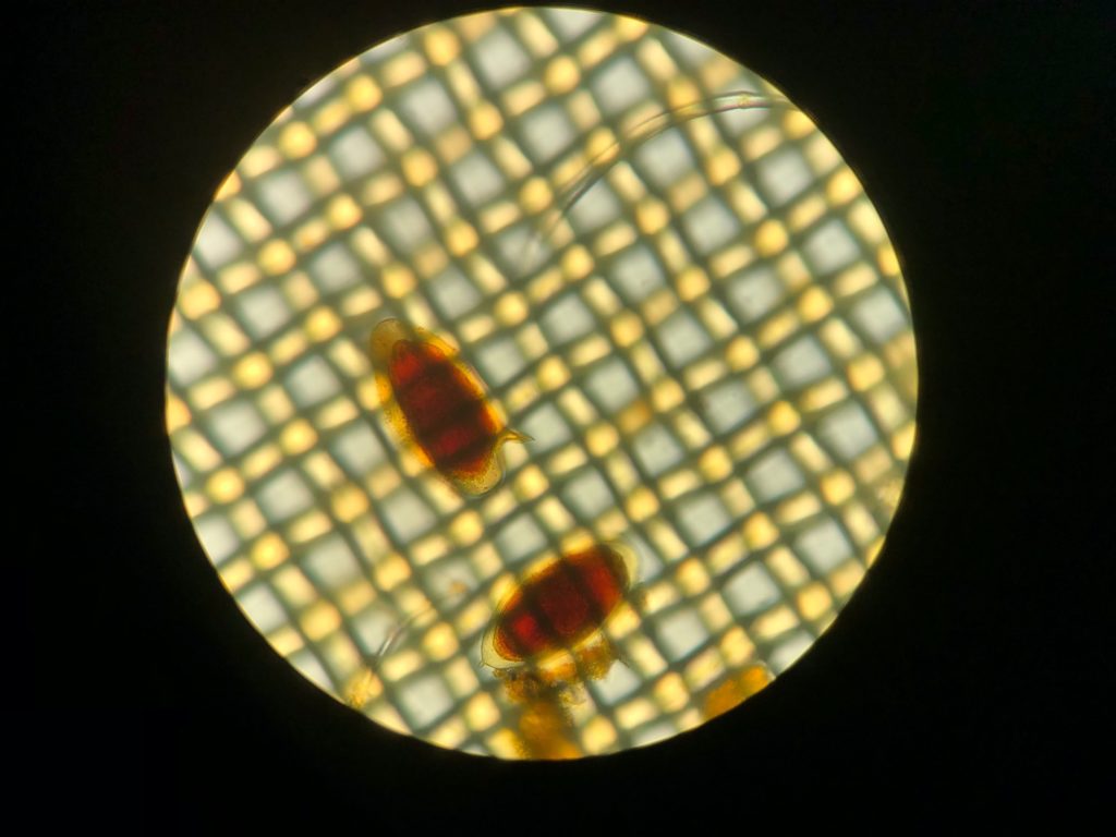 schistosomiasis malawi-tó)