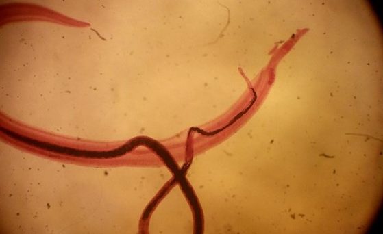 Paraziti schistosoma mansoni. Remedii naturale pentru parazitii intestinali