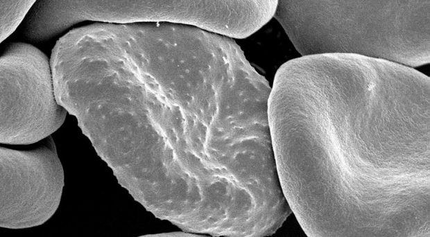 A newly discovered interaction between malaria and brain cells - Vimarsana News