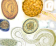 1024px-Helminths_eggs_(01)