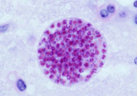 Toxoplasma gondii tissue cyst in mouse brain. Source: Jitinder P. Dubey, Public domain, via Wikimedia Commons