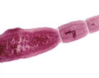 Echinococcus-multilocularis-adult