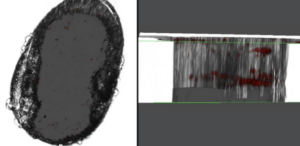 Greyscale image of light/confocal microscopy showing (left) a flea ovary and (right) 3D image through ovary including Y. pestis showing up as 'black' intensity.