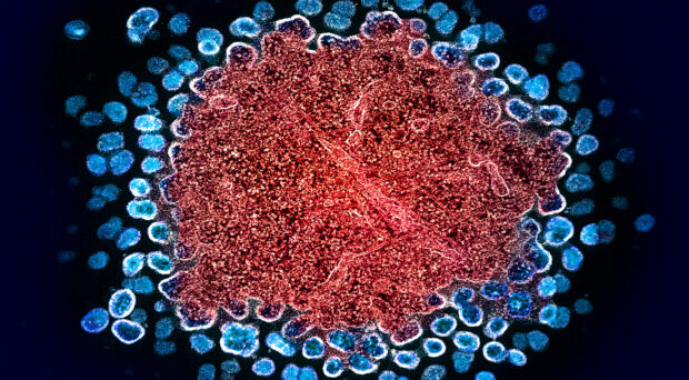 TEM image of HIV replication in a T-cell.