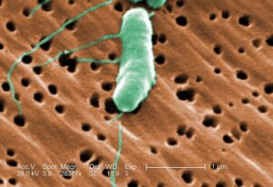 microscopic photograph of vibrio bacterium