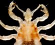 A body louse
