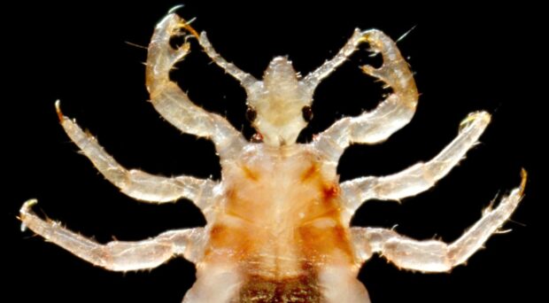 A body louse