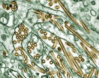 Colorized transmission electron micrograph of avian influenza A H5N1 (seen in gold) grown in MDCK cells (seen in green).