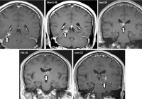 Brain MRI Scan over time Credit Nagui Antoun